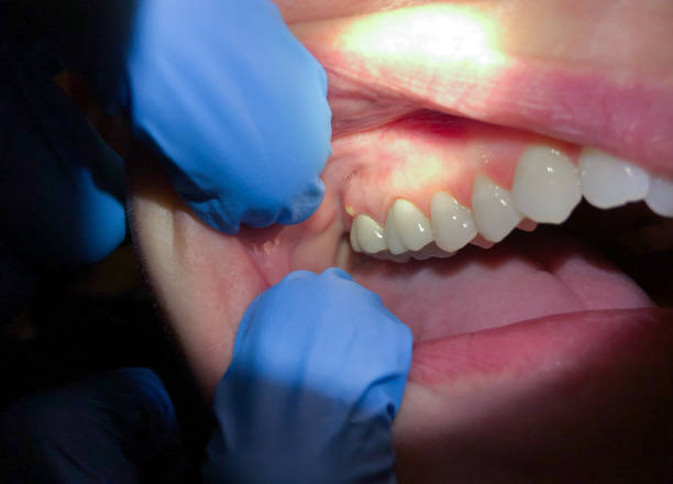 Best Emergency Orthodontic Repairs in San Augustine, TX