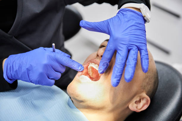 Best Walk-In Emergency Dentist in San Augustine, TX